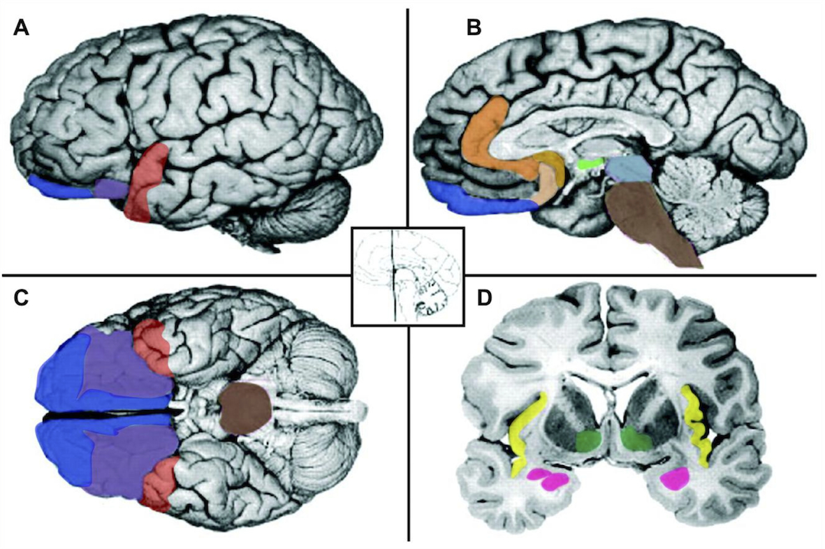 reseau cerebral emotionnel et reseaux de stress