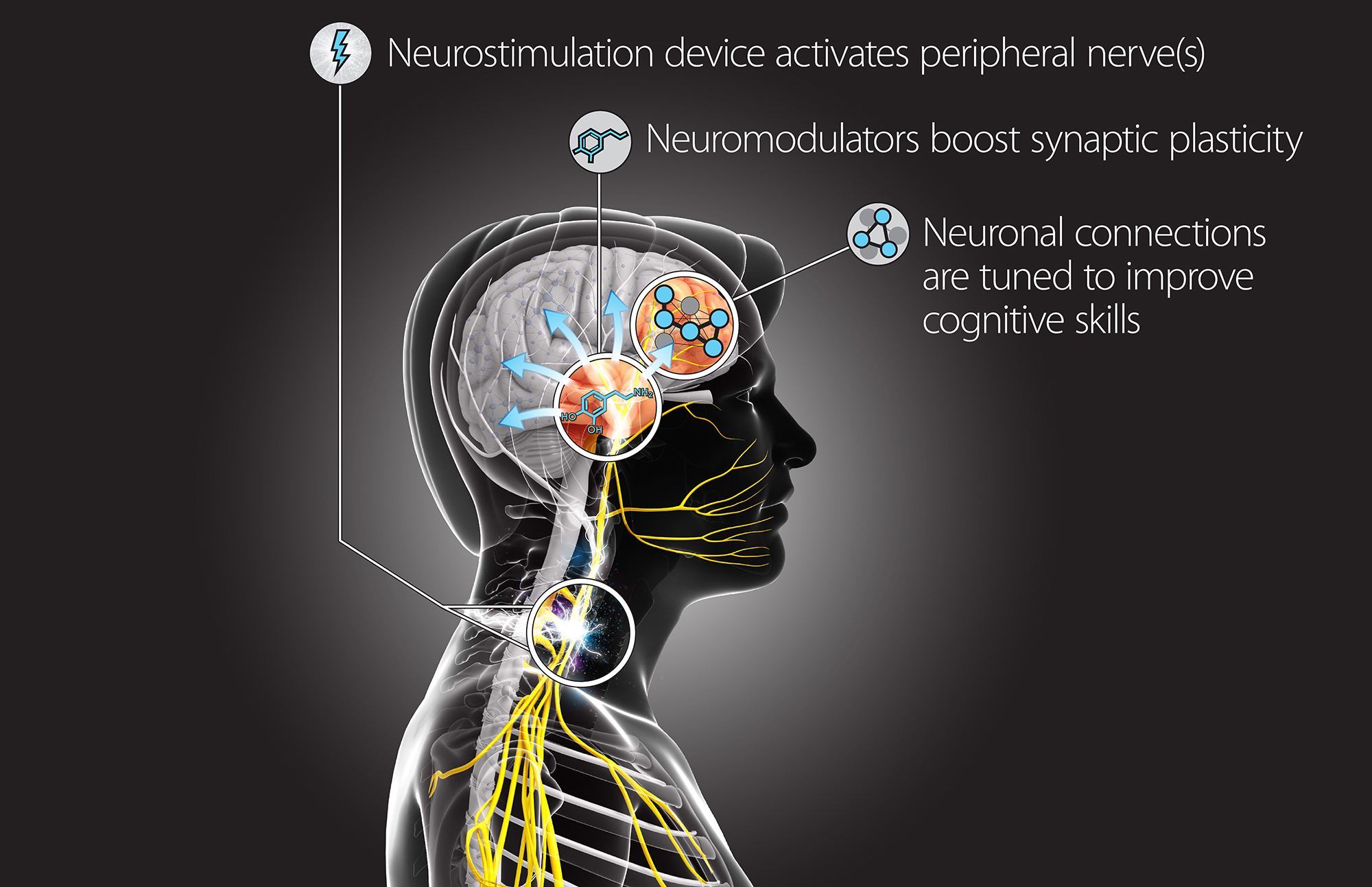 Neurostimulation